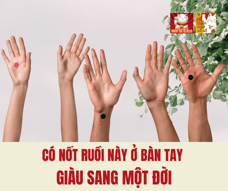 Có nốt ruồi này ở bàn tay giàu sang một đời